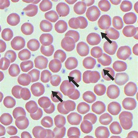 Platelet .